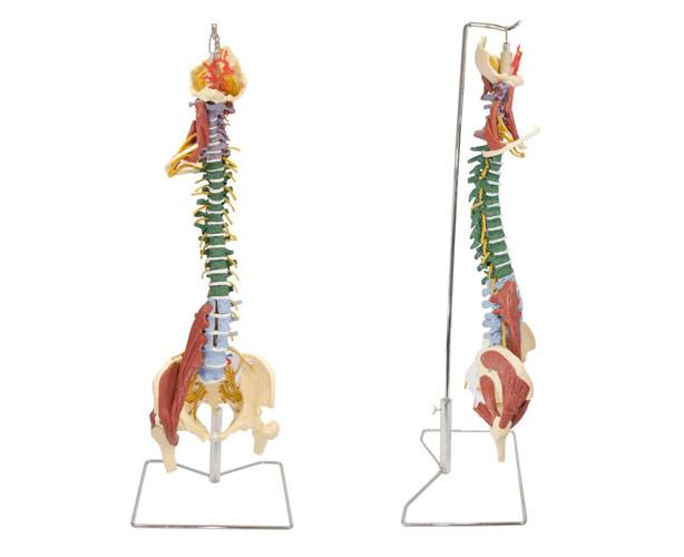 AWW-MSDM Muscle Spine With Disorders Model with Stand sku AWW-MSDM