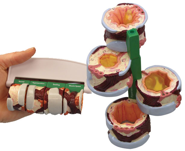 Bronchus Anatomy Model - 4 Piece - BRONCHUS4 - Personal Care  sku BRONCHUS4